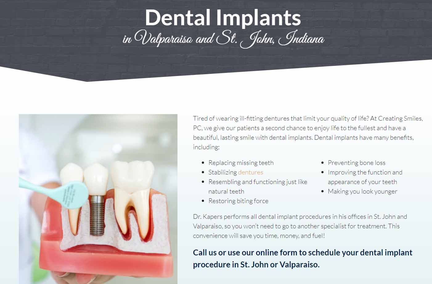 Web page about dental implants.
